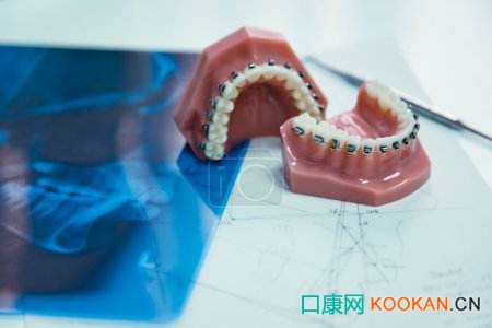 口腔行業(yè)開啟千億級市場，正畸醫(yī)生緊缺