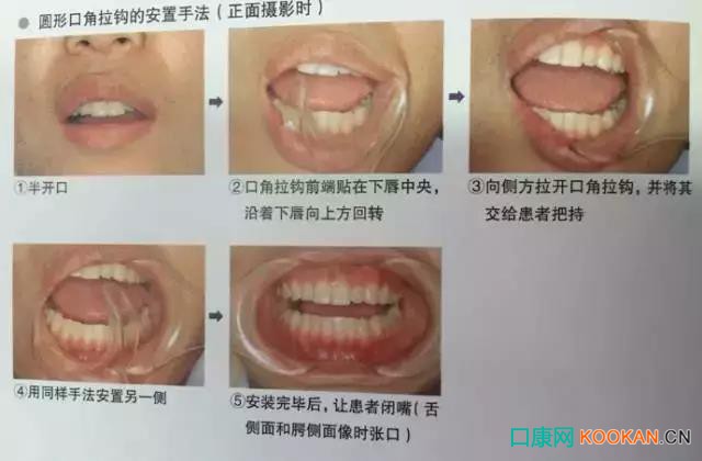 拍不好口腔照片怎么辦？這些口腔攝影方法與技巧請收好！