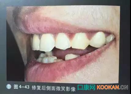 拍不好口腔照片怎么辦？這些口腔攝影方法與技巧請收好！